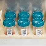 微生物樣本前處理系統(tǒng) AutoStreak S1800